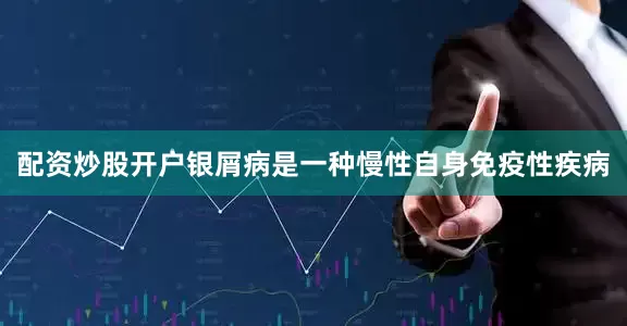 配资炒股开户　　银屑病是一种慢性自身免疫性疾病